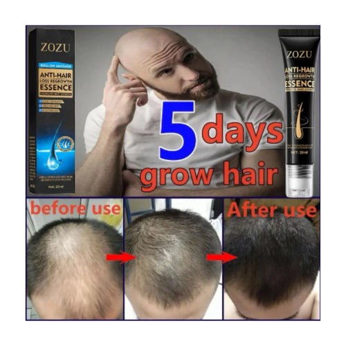 Resultados visibles de cabellos más densos y brillantes después del uso del Hair Boost Essence - Activador de Crecimiento Capilar. Ingredientes naturales del Hair Boost Darken Strengthen Essence: aceite de semilla de uva y extracto de jengibre.