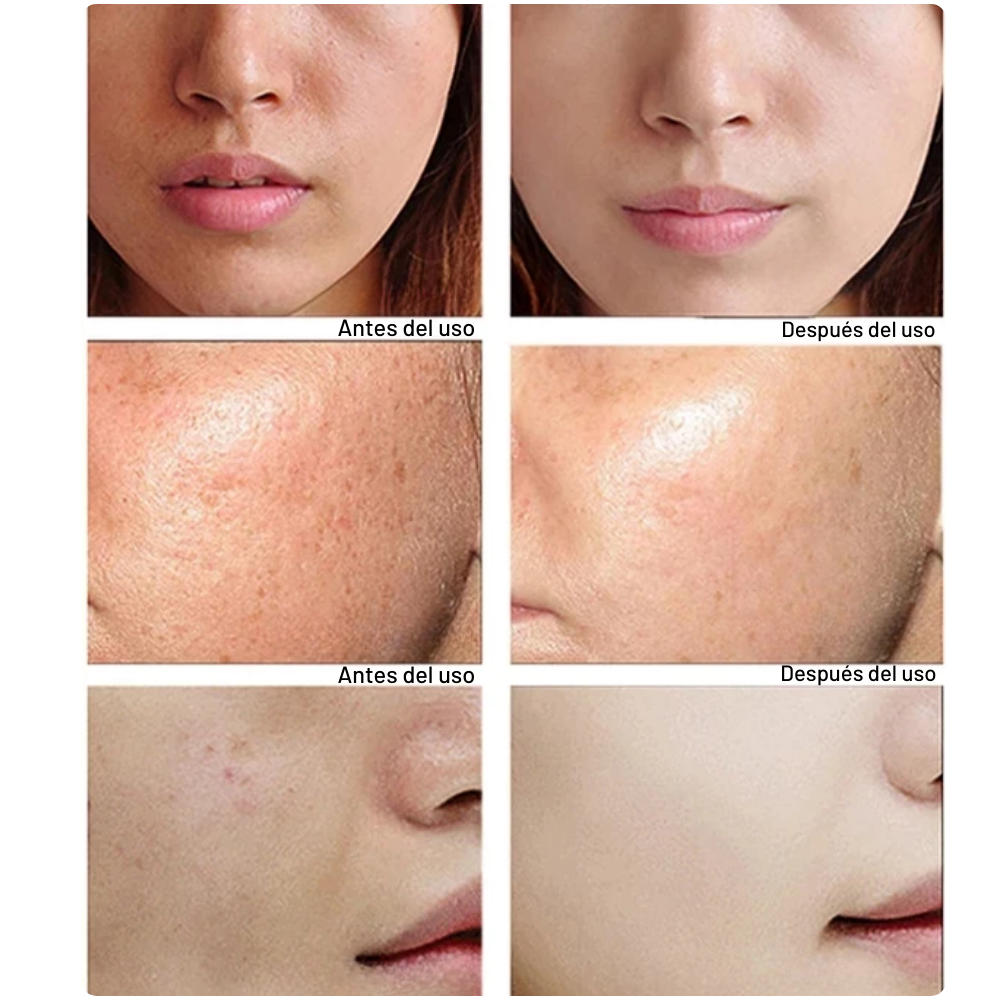 Combo de Belleza Eficaz - Rejuvenecimiento Instantáneo de la Piel
