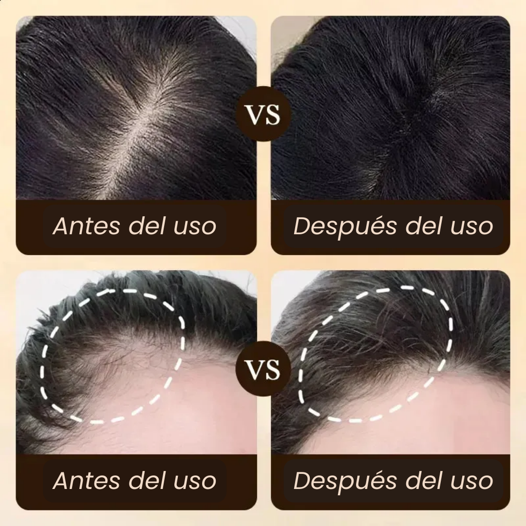 Resultados visibles de cabellos más densos y brillantes después del uso del Hair Boost Essence - Activador de Crecimiento Capilar. Ingredientes naturales del Hair Boost Darken Strengthen Essence: aceite de semilla de uva y extracto de jengibre.