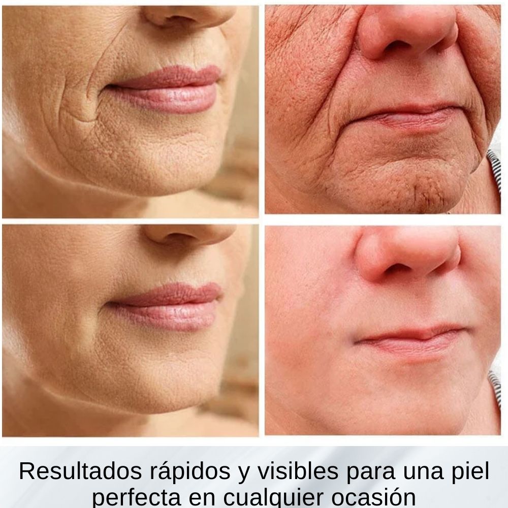 SERUM 24K BIOAQUA reduzca efectivamente las manchas y cicatrices, hidrate profundamente y mejore la luminosidad de la piel.