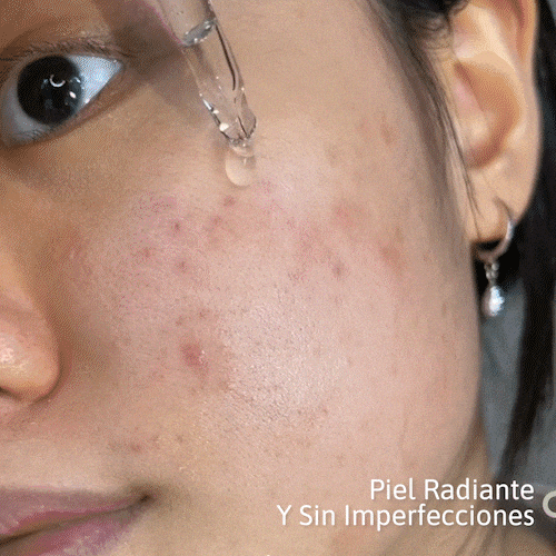 SERUM 24K BIOAQUA reduzca efectivamente las manchas y cicatrices, hidrate profundamente y mejore la luminosidad de la piel.
